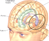 alcoholism memory loss